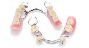 removable partial dentures